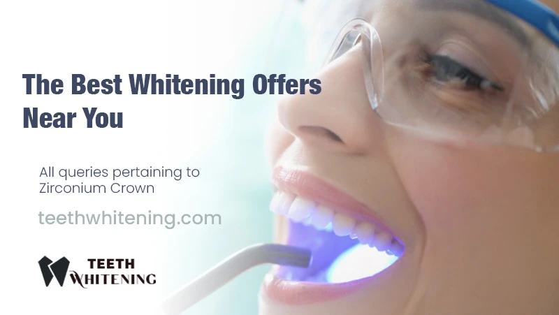 The Best Whitening Offers Near You