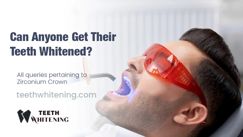 Kan Iedereen Hun Tanden Witter Maken?