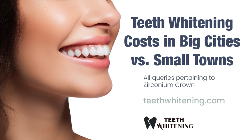 Teeth Whitening Costs in Big Cities vs. Small Towns