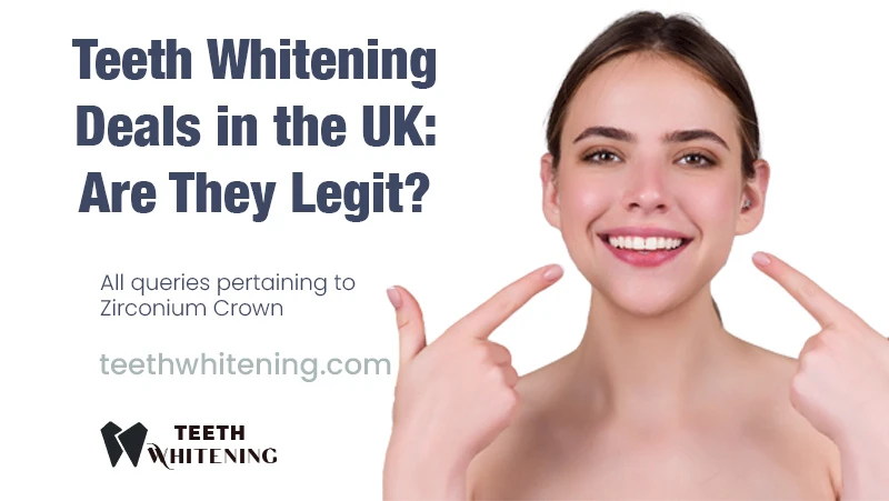 Teeth Whitening Deals in the UK: Are They Legit?