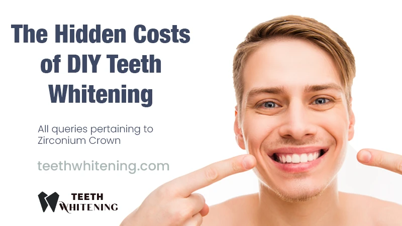 The Hidden Costs of DIY Teeth Whitening